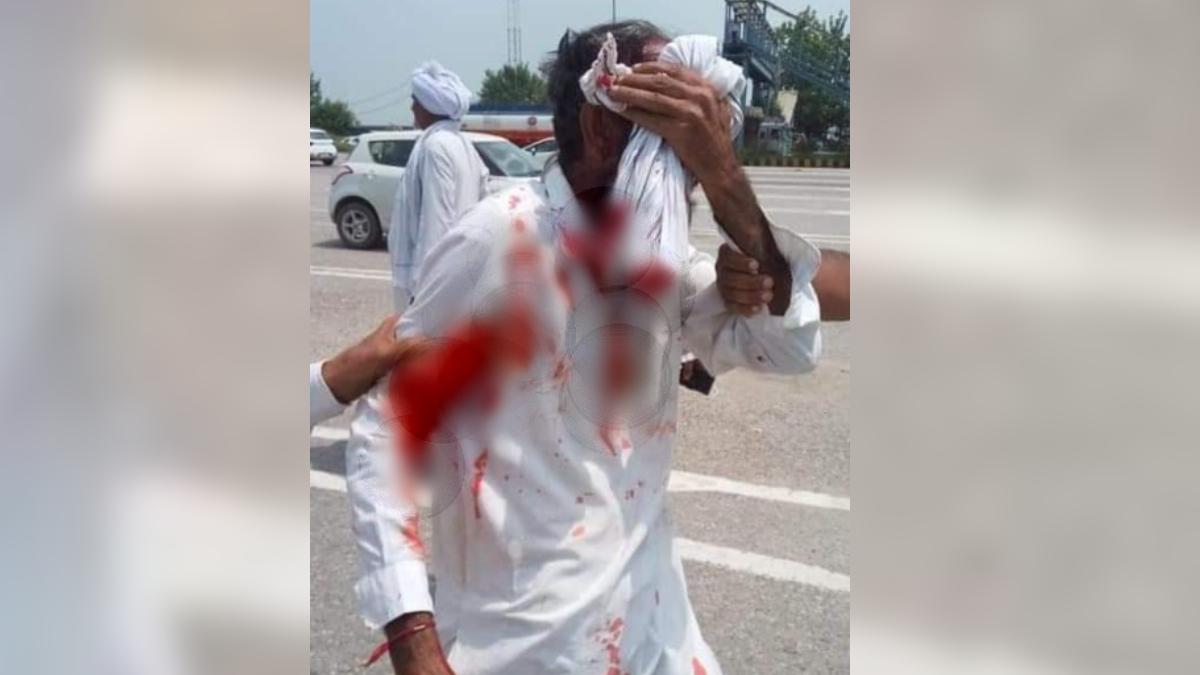 लाठीचार्ज में कई प्रदर्शनकारी घायल हुए हैं. 