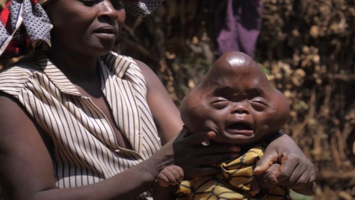 मां-बेटे की तस्वीर (Credit- Afrimax) 