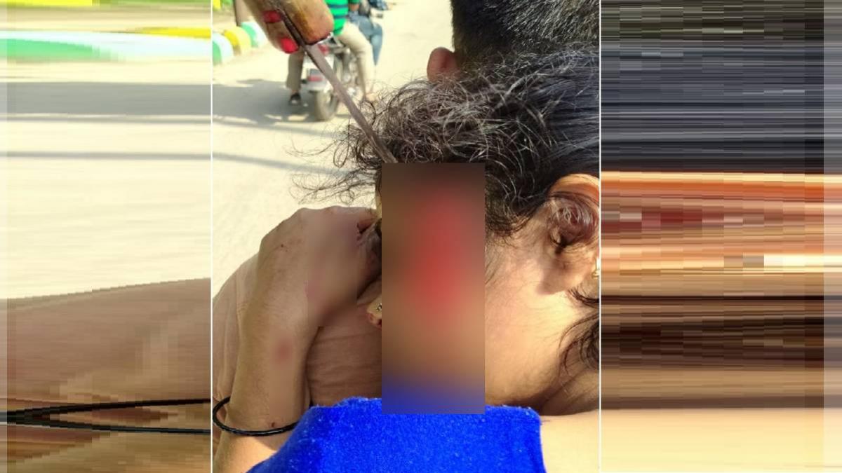 घायल महिला को उपचार के लिए अस्पताल ले जाया गया है