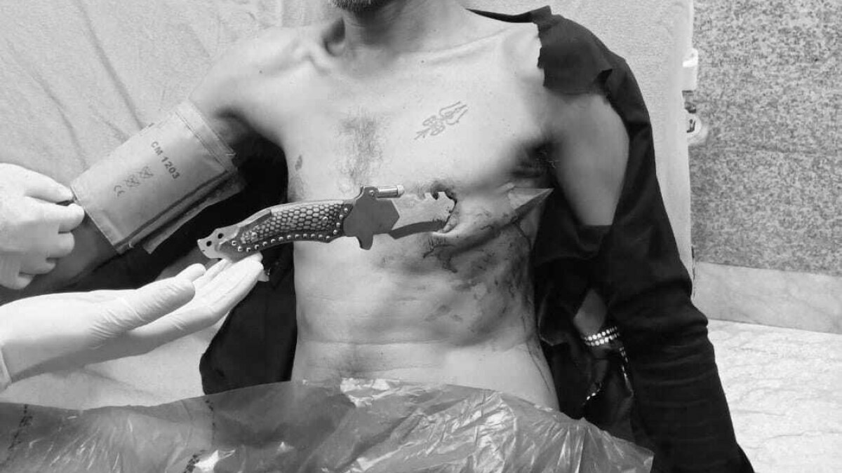 भोपाल: सीने में घुसे 10 इंच लंबे चाकू के साथ हॉस्पिटल पहुंचा युवक, फिर...