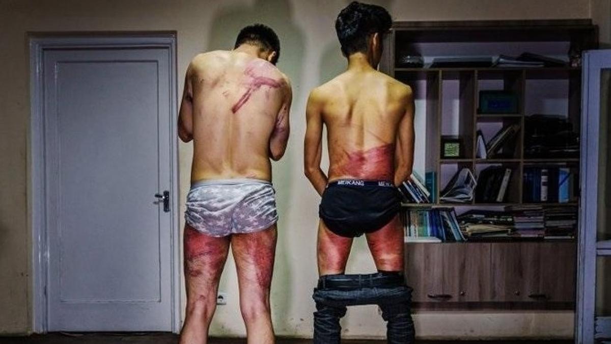 तालिबान ने पत्रकारों की जमकर पिटाई की (फोटो: LA Times)