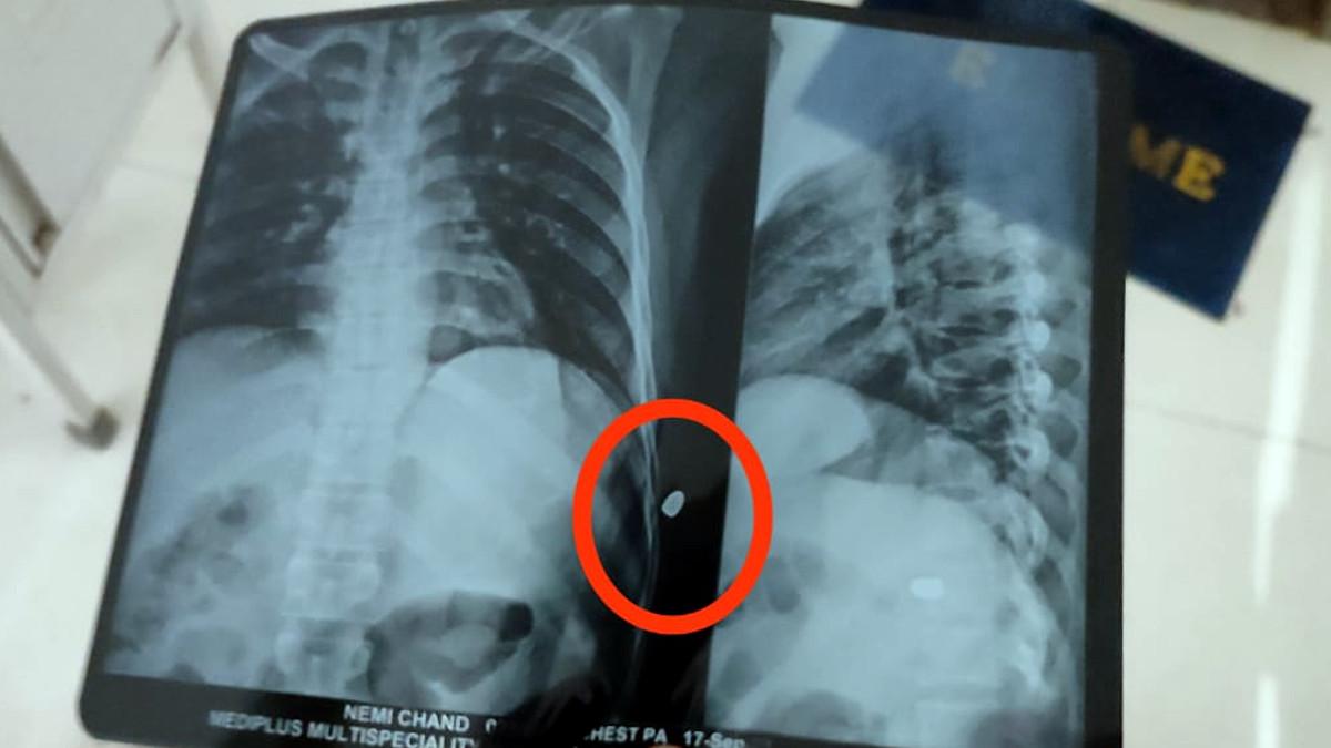 सीने में फंसी गोली. 