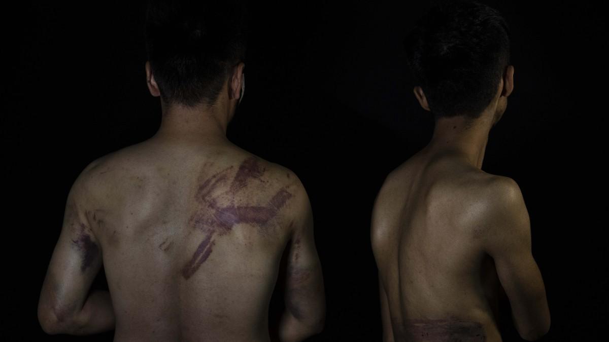 महिलाओं के प्रदर्शन को कवर करने पहुंचे पत्रकारों को तालिबानियों ने बेरहमी से पीटा था (फोटो- पीटीआई)