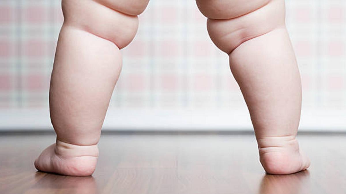 World Pediatric Bone and Joint Day (Photo Credit: Getty Images)