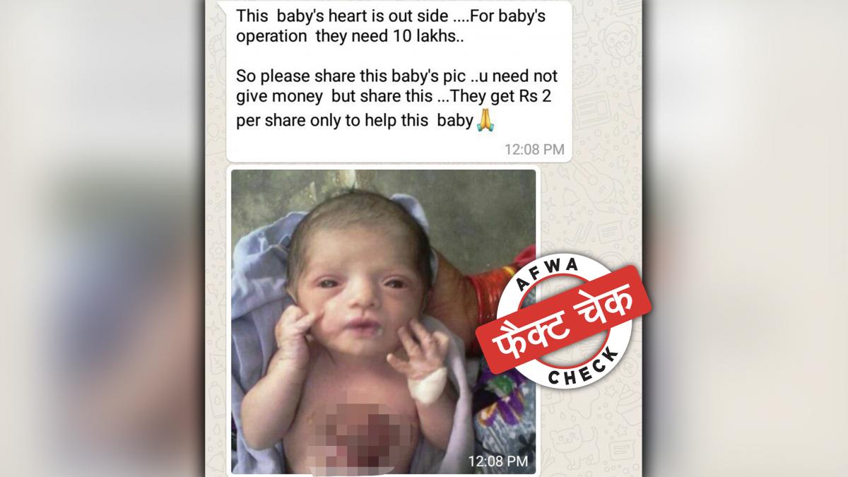 मृत बच्ची की तस्वीर वायरल कर लाइक-शेयर बंटोरे जा रहे हैं. 