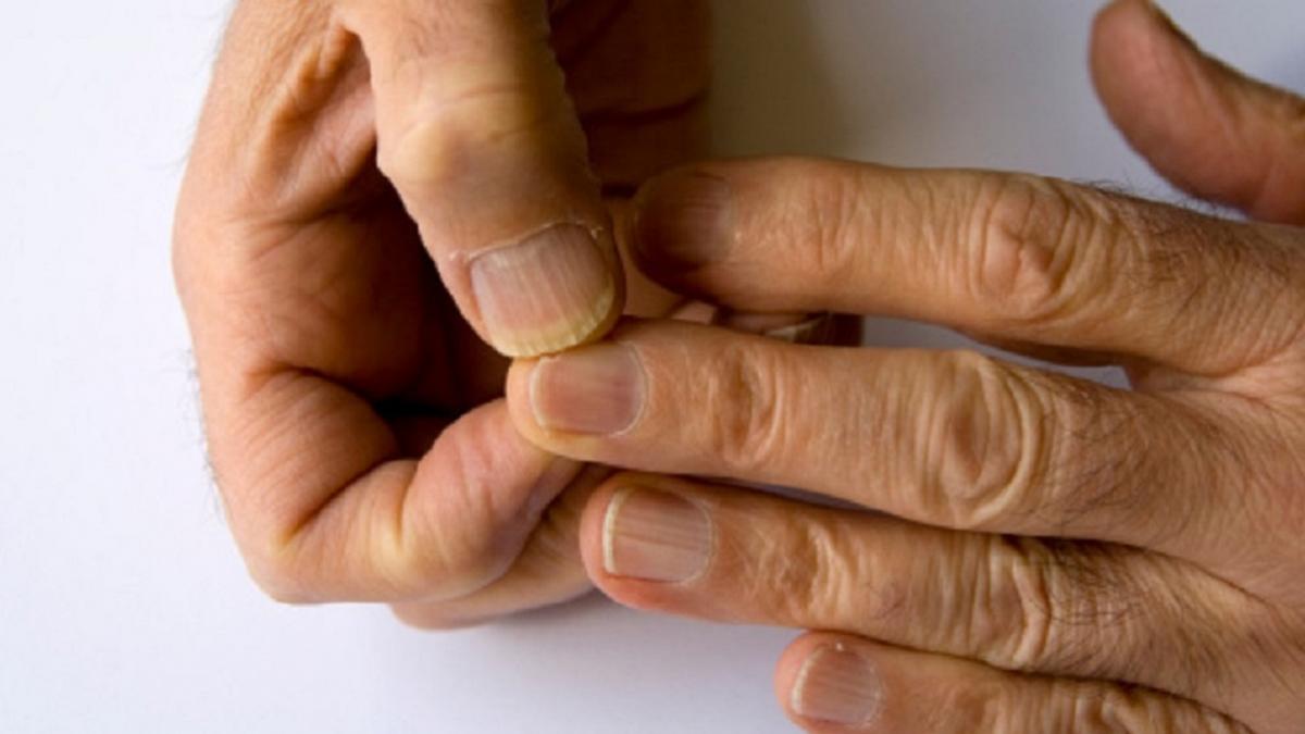 ये 3 आसान टेस्ट 30 सेकेंड में बता देंगे कितने हेल्दी हैं आप (Photo: Getty Images)