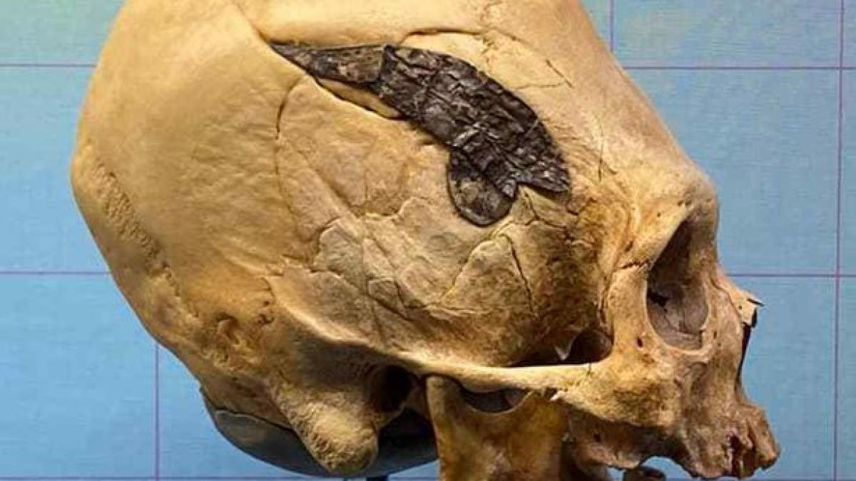 The unique skull (Image: Museum of Osteology)