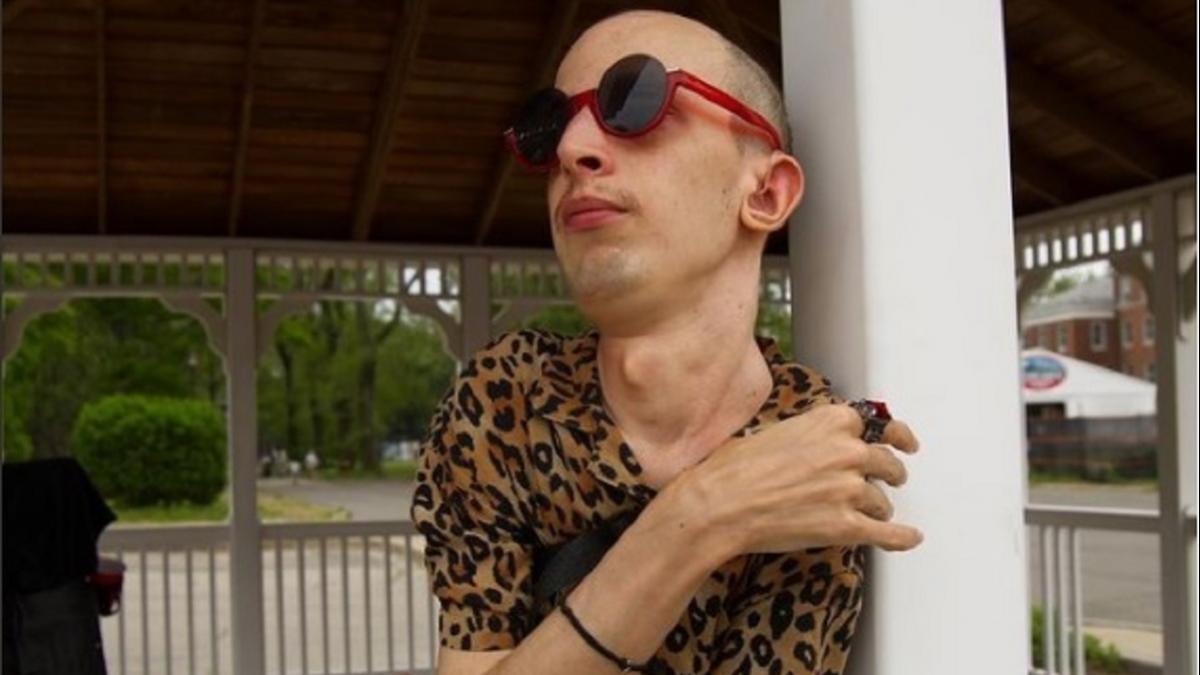 Stone Man Syndrome से जूझ रहे हैं Joe Sooch (Source: Instagram)