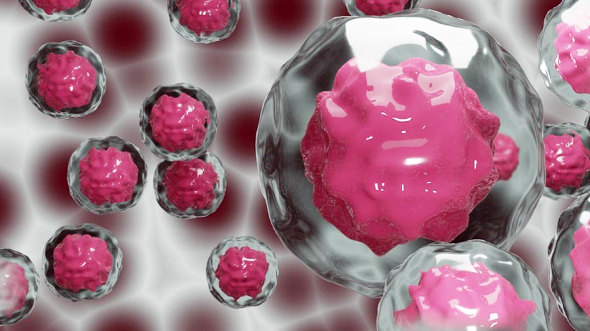 नई तकनीक से ठीक हुई HIV की महिला मरीज