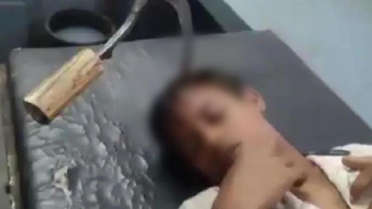 बच्चे के सिर में घुसा नुकीला हथियार.