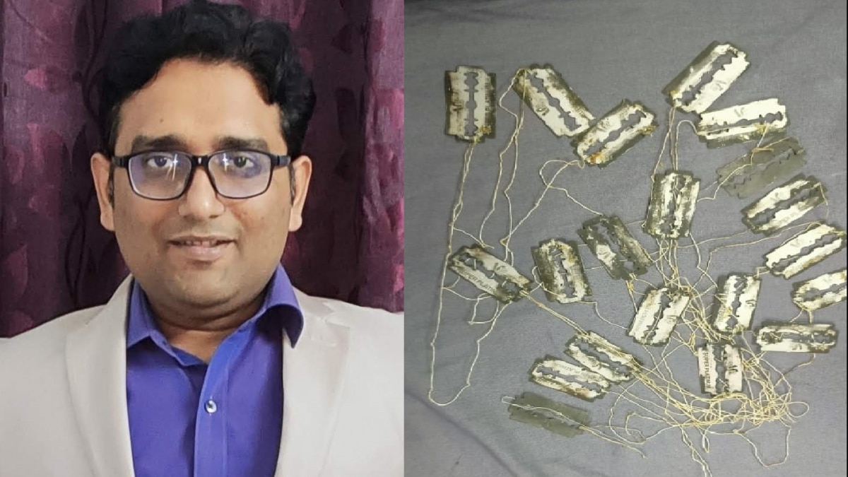 जादूगर के आंत से निकाली गई ब्लेड