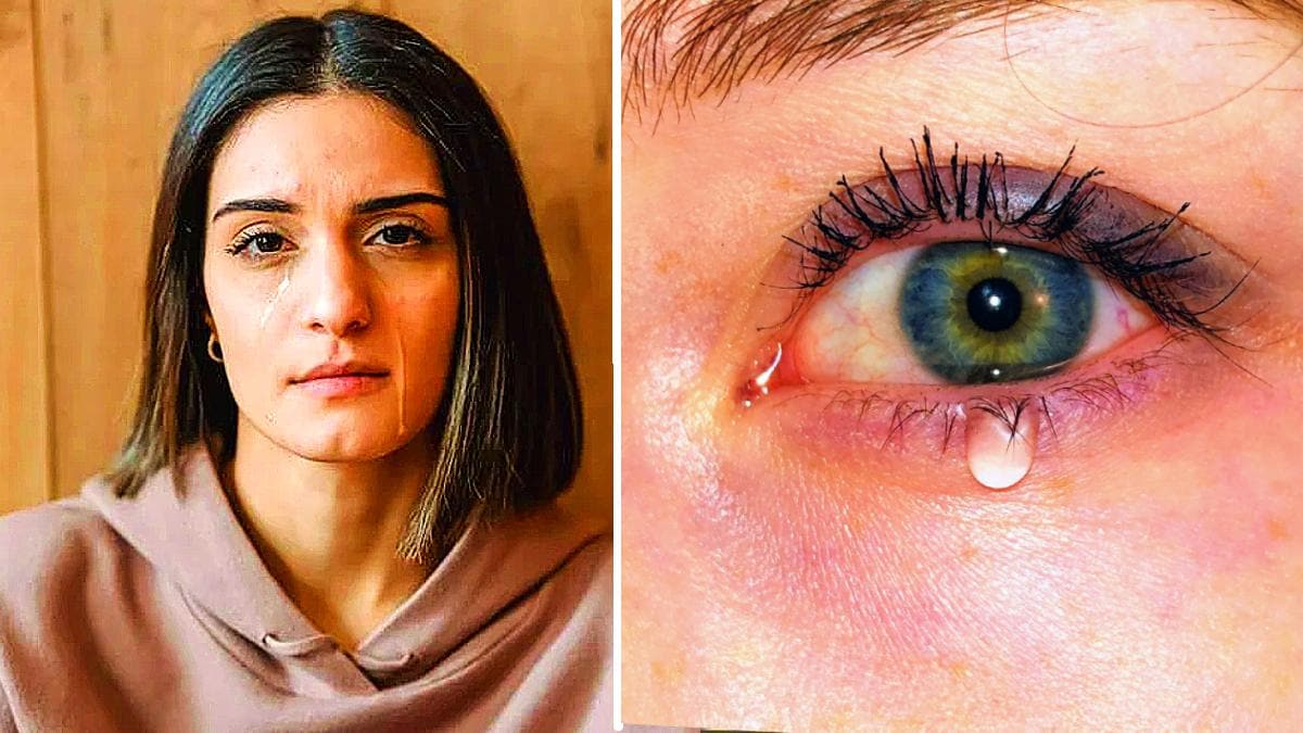 Watery Eyes: आपकी आंखों में तो नहीं आता रहता पानी? बड़ी गड़बड़ी का है संकेत - Watery Eyes epiphora or tearing Causes Treatment Dry Eyes Blocked Tear Ducts Pinkeye Allergies tlif - AajTak