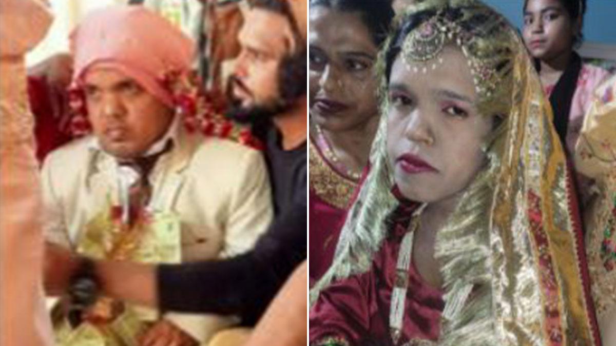 UP: 3 फुट की दुल्हन को मिला साढ़े तीन फुट का दूल्हा, चर्चाओं में आ गया रामपुर का ये कपल