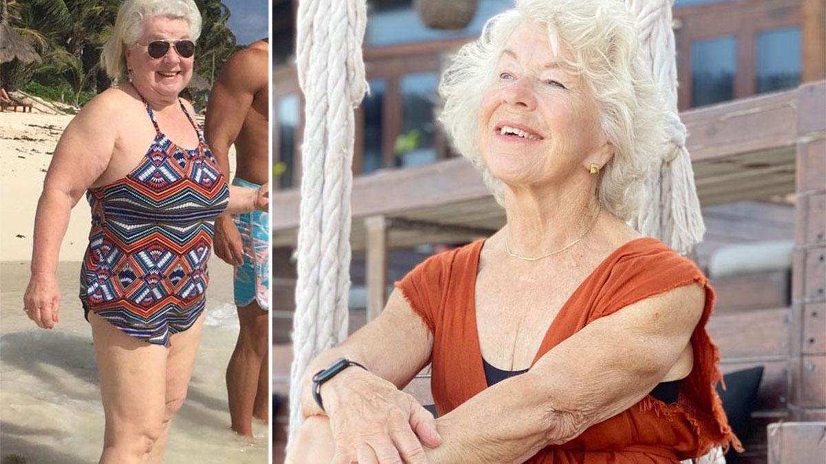76 साल की महिला ने शेयर की पुरानी तस्वीर, 5 साल का ट्रांसफॉर्मेशन देखकर चौंके लोग