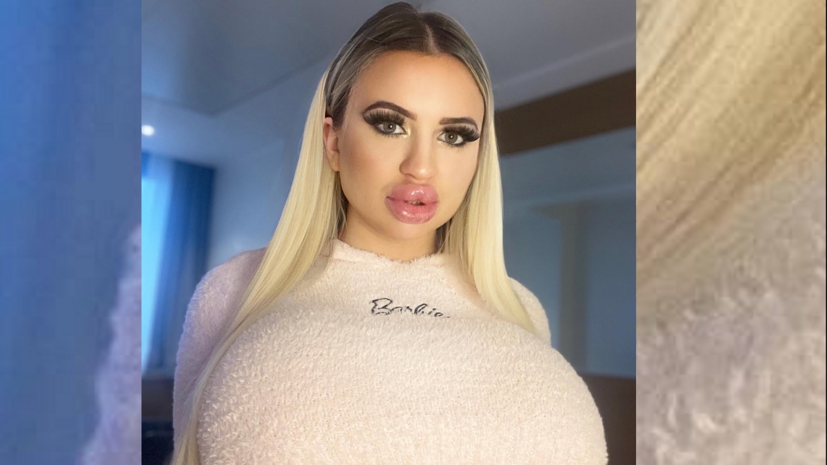 'सबसे अधिक खूबसूरत' दिखने के लिए मॉडल ने 4 बार कराई ब्रेस्ट सर्जरी!