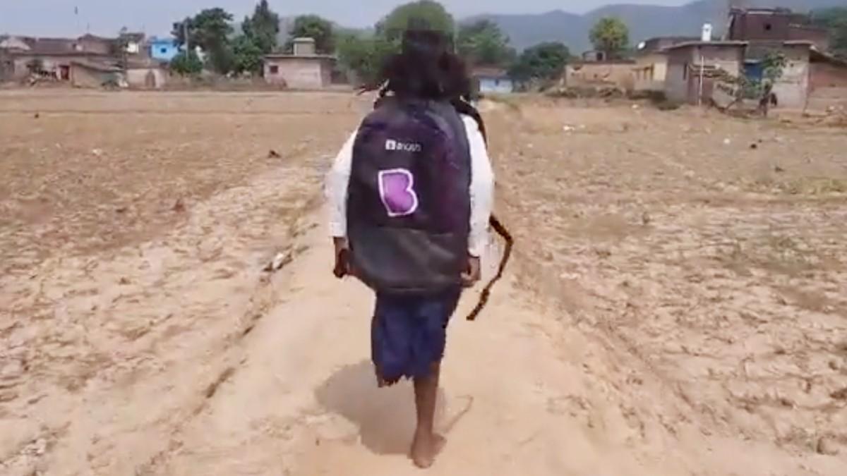 हादसे के बाद मासूम का पैर काटना पड़ा था.  