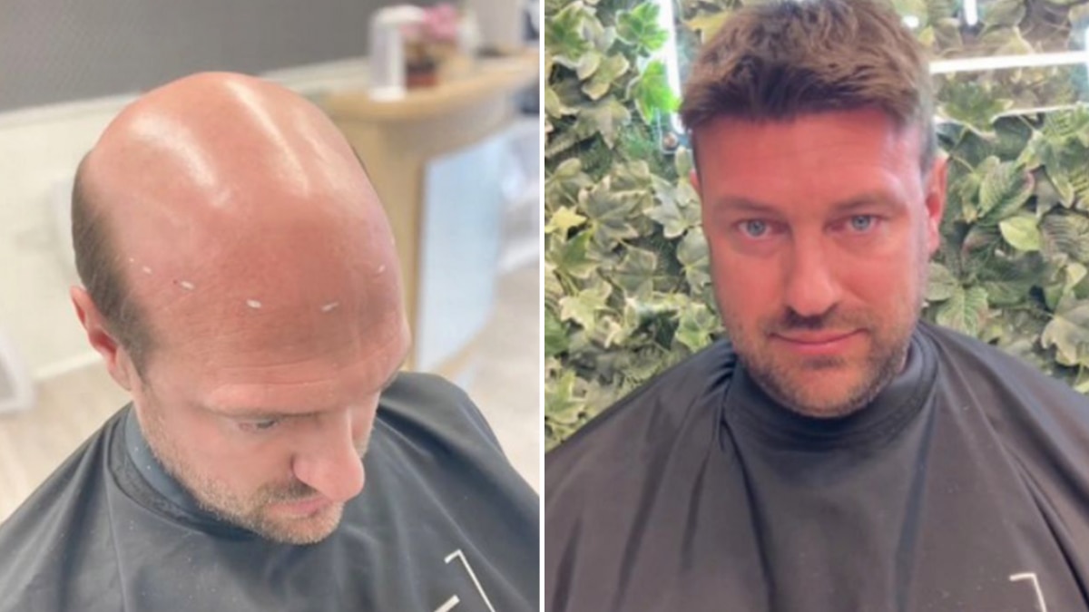 नाई ने किया ऐसा चमत्कार, उम्र से 20 साल छोटा दिखने लगा शख्स!