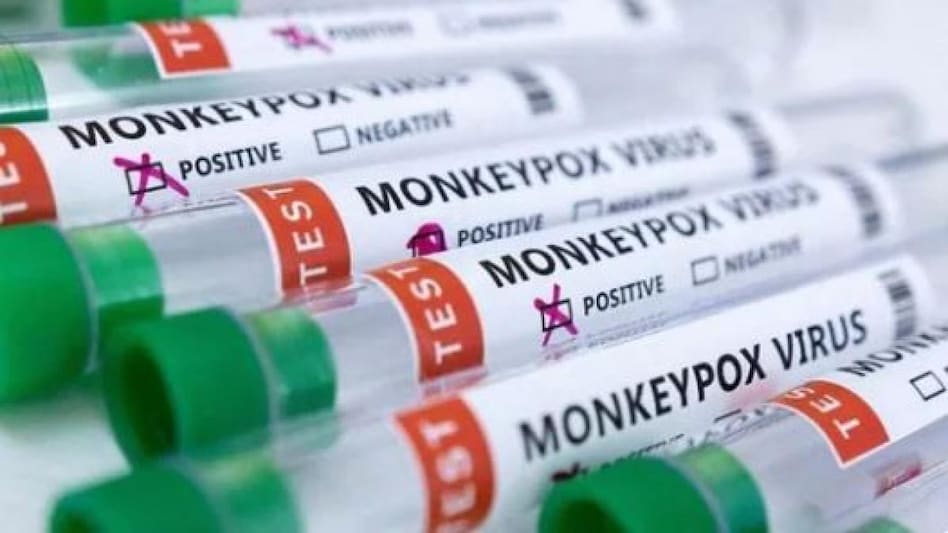 monkeypox cases: क्या देश में बढ़ रहे मंकीपॉक्स के केस? केरल, दिल्ली के बाद अब तेलंगाना में मिला संदिग्ध मरीज - Monkeypox suspected case in Telangana Kamareddy district ntc - AajTak
