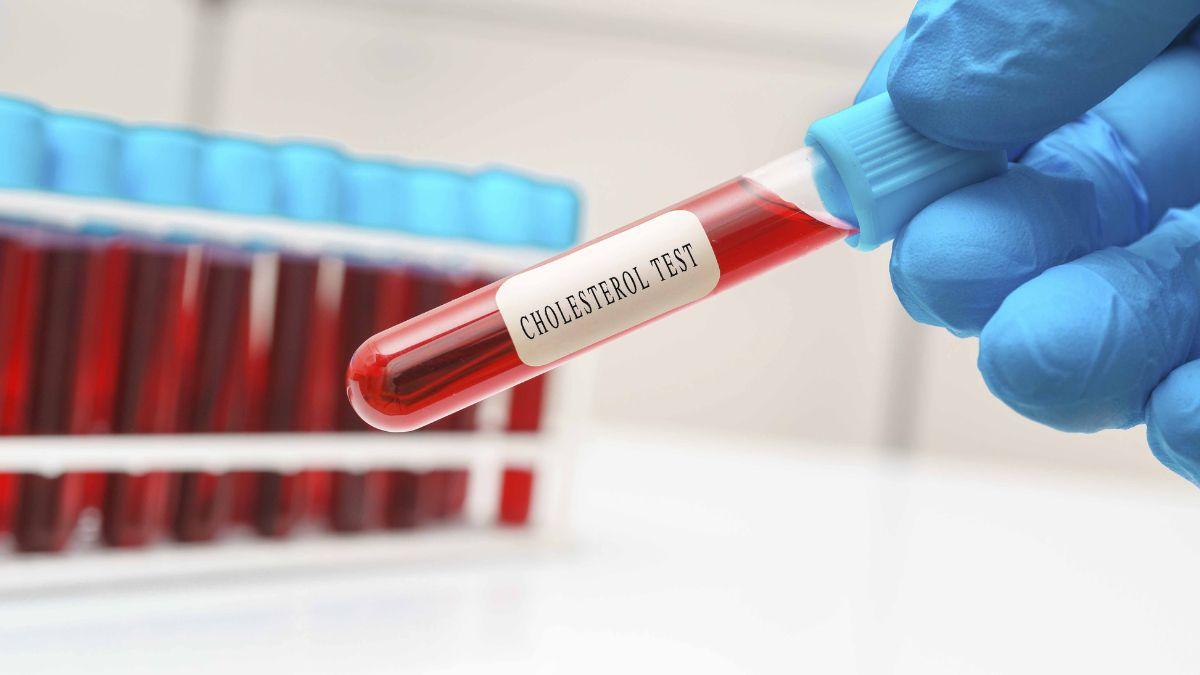 हार्ट अटैक से है बचना तो इस उम्र से ही शुरू कर दें कोलेस्ट्रॉल लेवल चेक करना (Photo Credit: Getty Images)