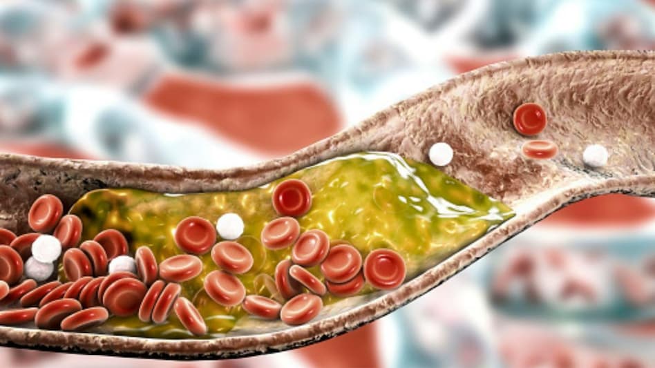 दिल की बीमारियों को कंट्रोल करने में कारगर है हरा प्याज, जानिए यूज का तरीका… - Green onion is effective in controlling heart diseases, know the method of use…