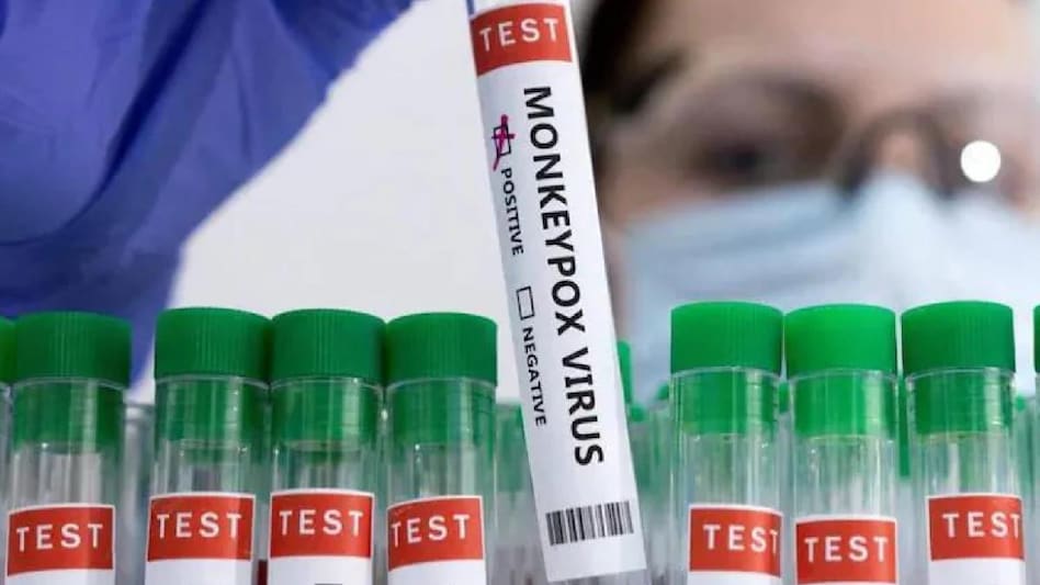 अब दिल्ली में Monkeypox के 2 संदिग्ध मिले, अफ्रीकी मूल के सस्पेक्ट LNJP अस्पताल में भर्ती - monkeypox suspects African origin found in Delhi ntc - AajTak