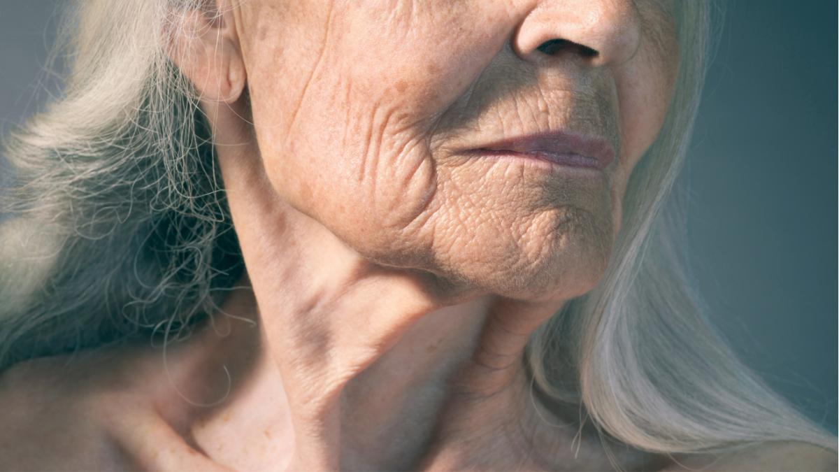 स्किन के लिए जहर मानी जाती है ये 4 चीजें, आज ही बंद कर दें खाना (Photo Credit: Getty Images)