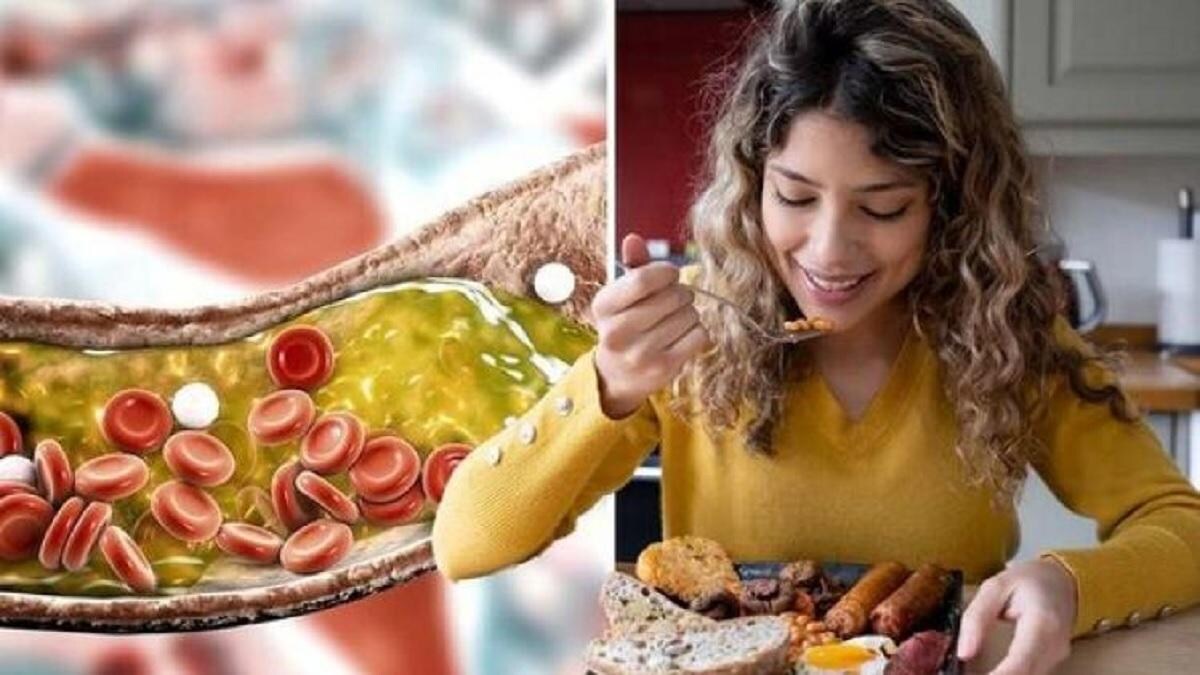 हाई कोलेस्ट्रॉल से हैं परेशान तो बंद कर दीजिए ये चीजें खाना, नहीं जमेगा बैड कोलेस्ट्रॉल - reduce your cholesterol level natural ways to remove bad cholesterol tlif - AajTak