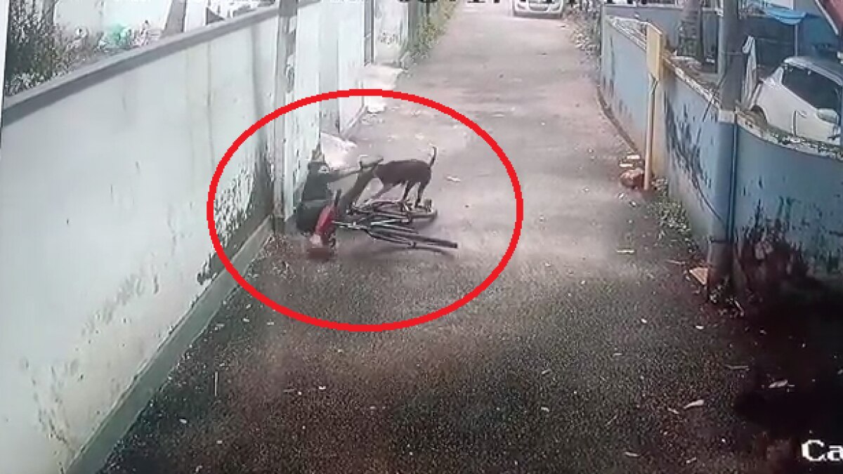 बच्चे पर कुत्ते ने किया हमला