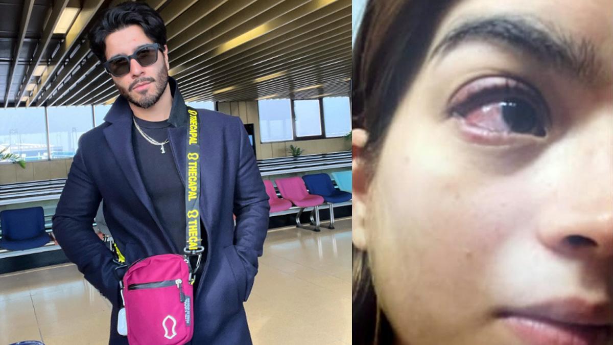 हाथों पर निशान-आंख में लगी चोट, Pak एक्टर ने पत्नी को मार-मारकर किया जख्मी, निशान देख आंखों में आ जाएंगे आंसू