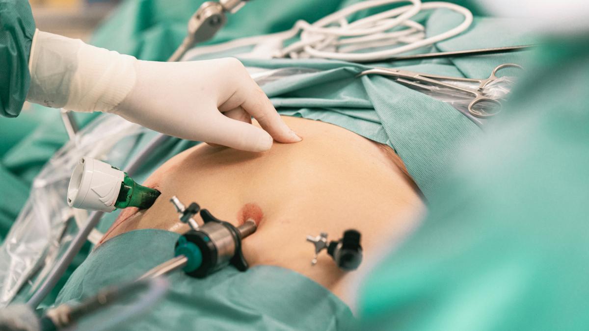 वेट लॉस सर्जरी से महिला की मौत! (pc: Getty Images)