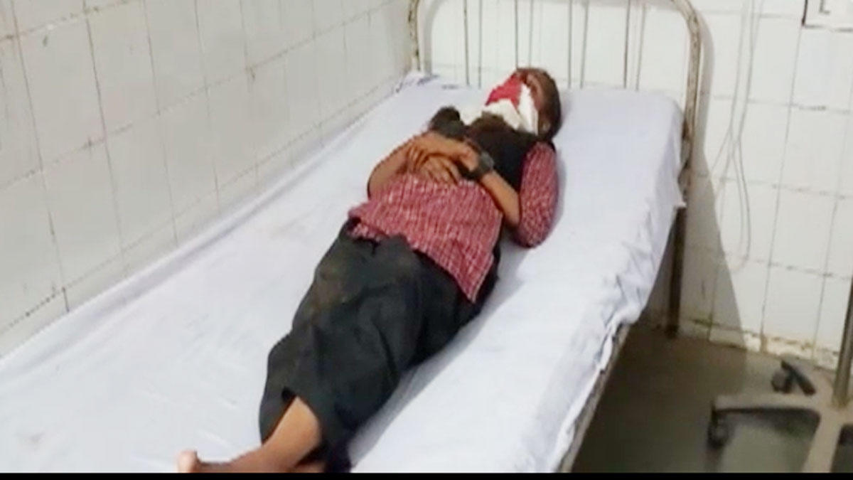 स्कूली  बच्चों से भरी टवेरा यात्री बस से टकराई (फोटो-आजतक)