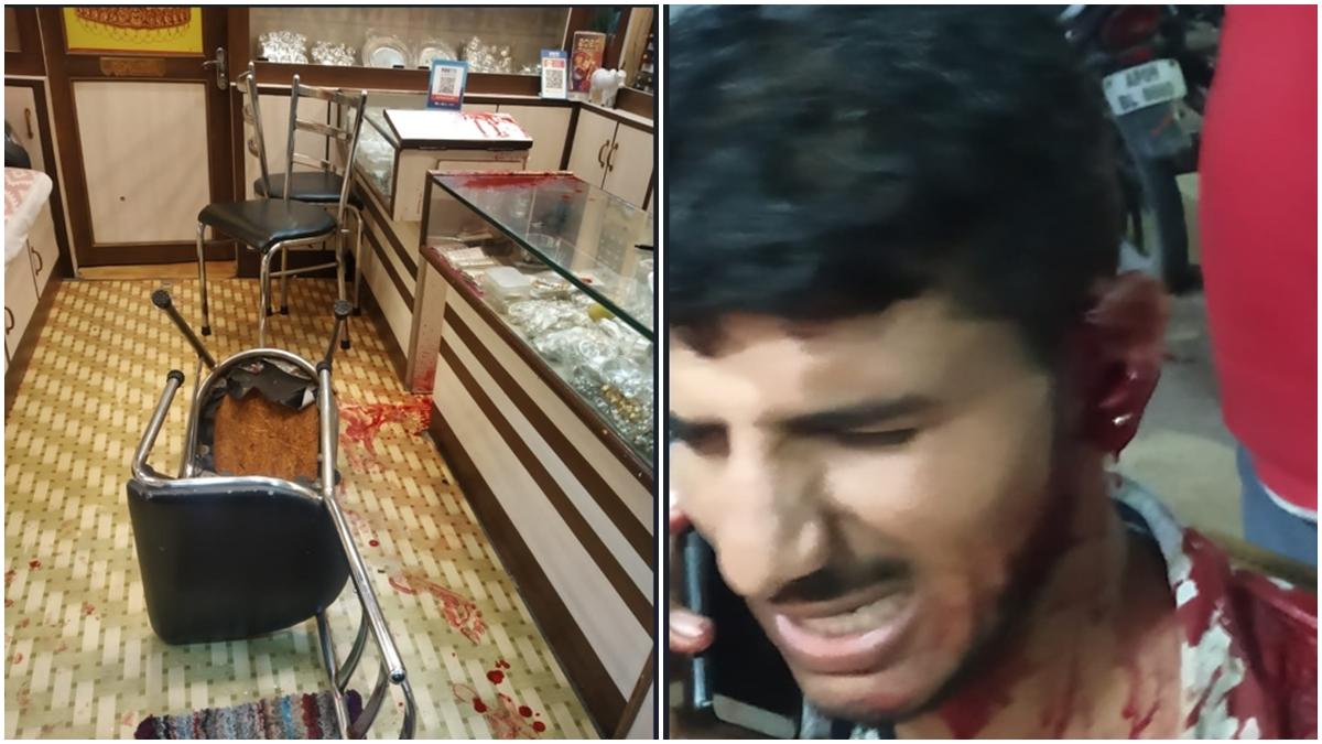 ज्वैलरी शॉप लूटने आए बदमाशों ने की फायरिंग, मालिक सहित दो घायल 
