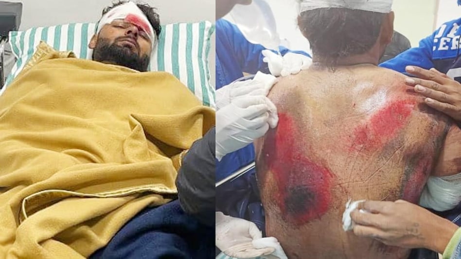 भारतीय टीम के स्टार विकेटकीपर बल्लेबाज ऋषभ पंत को कार एक्सीडेंट में गंभीर चोटें आईं.