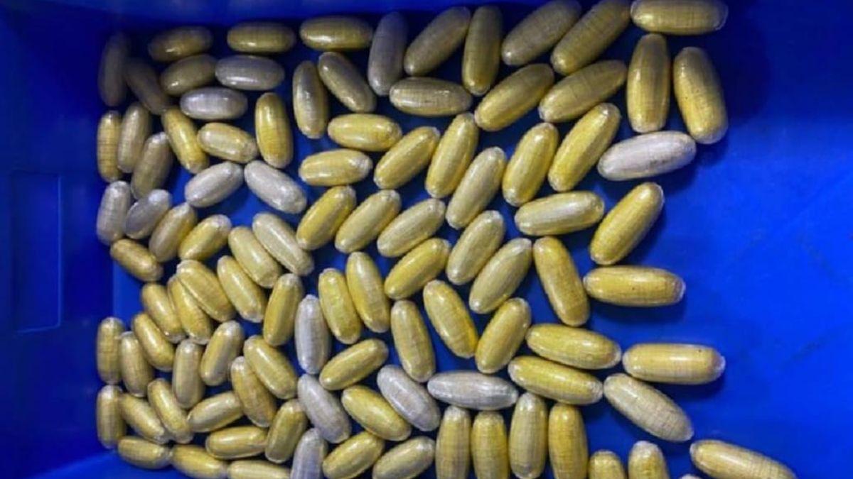 महिला के शरीर से निकले कोकीन के कैप्सूल. 