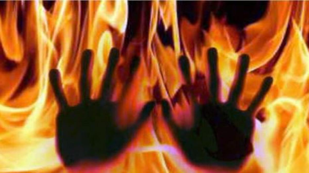 आग में झुलसी सात महीने की गर्भवती महिला