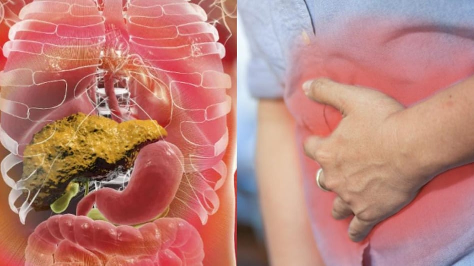 फैटी लिवर की समस्या से पाना चाहते हैं छुटकारा? ये उपाय करेंगे आपकी मदद - Fatty liver disease remedies you need to try now tlifn - AajTak