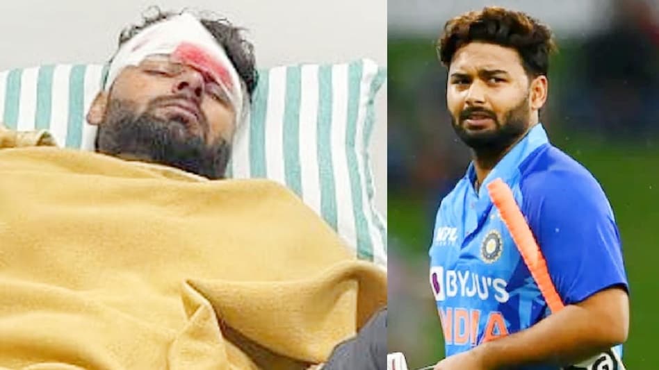 rishabh pant car accident 3 Rishabh pant debut match : मुझे यकीन हुआ जिस तरह मुझे बिच मैदान पर …..