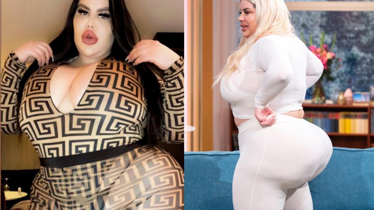 महिला ने ऑपरेशन पर खर्च किए एक करोड़ (तस्वीर- इंस्टाग्राम)