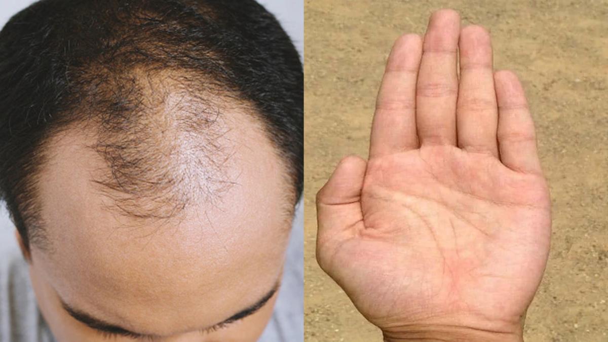 प्रतीकात्मक तस्वीर (PC: Getty)