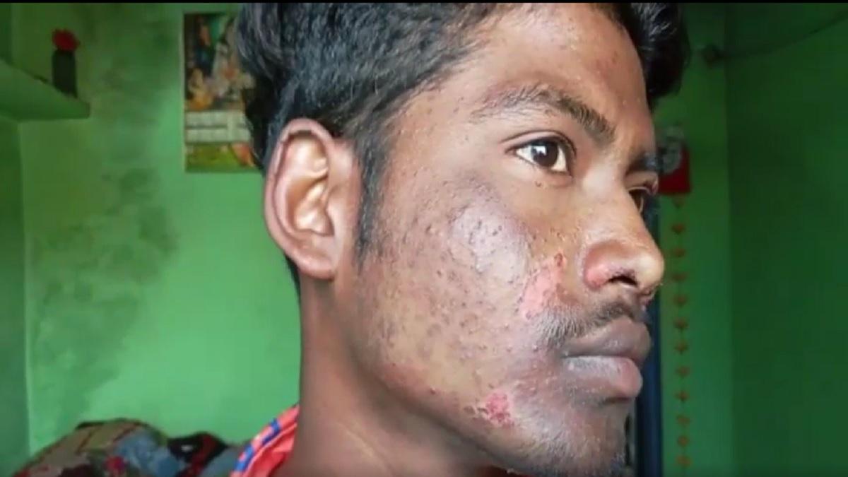 जख्मी युवक दीपक.