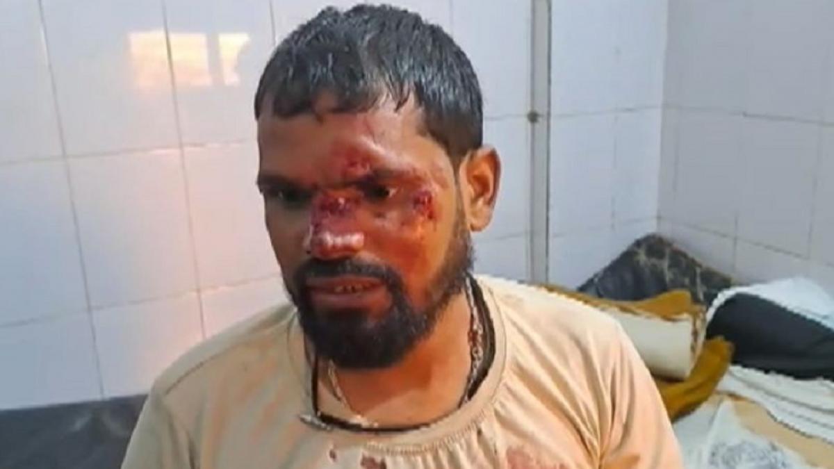 जमुई में बड़ा सड़क हादसा, कई लोग घायल