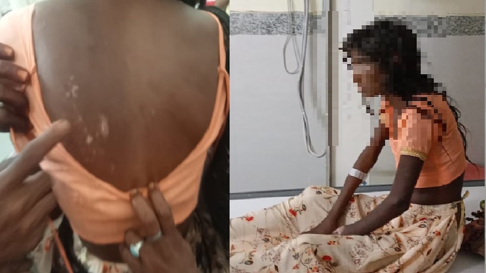 गर्म सलाखों से दागा, दांत तोड़े फिर बुलाई जेसीबी... डायन बताकर बहू को दी गईं खौफनाक यातनाएं - In laws tortured daughter in law by calling her witch in Bhilwara district lclp -