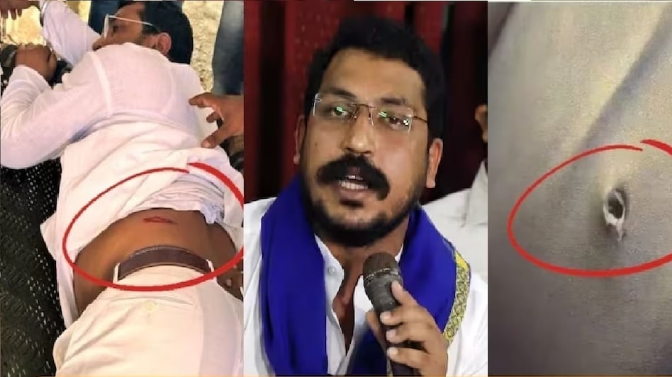 भीम आर्मी चीफ चंद्रशेखर आजाद पर हुआ था हमला.