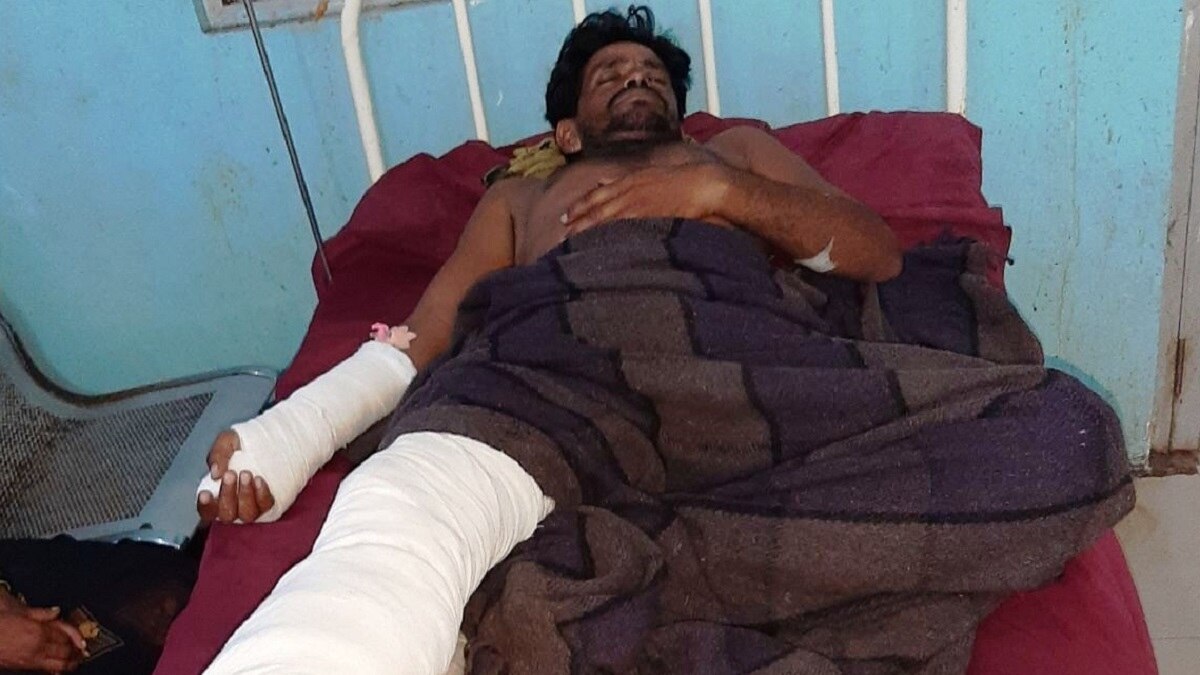 धौलपुर में मगरमच्छ ने शख्स को किया घायल