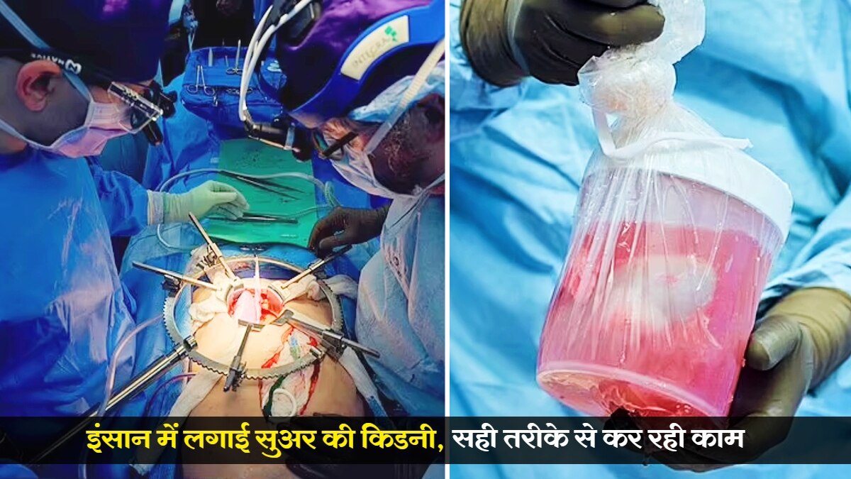 Image credit: nyu langone health