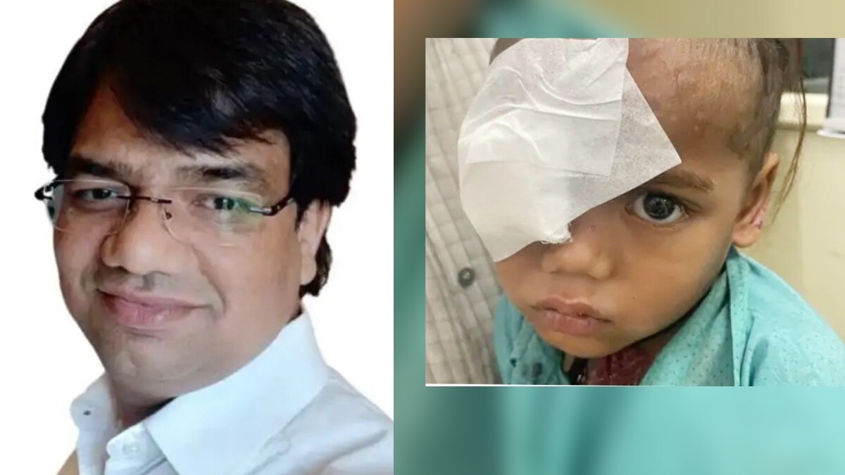 ऑपरेशन करने वाले डॉक्टर गिरीश चतुर्वेदी और पीड़ित बालक. 