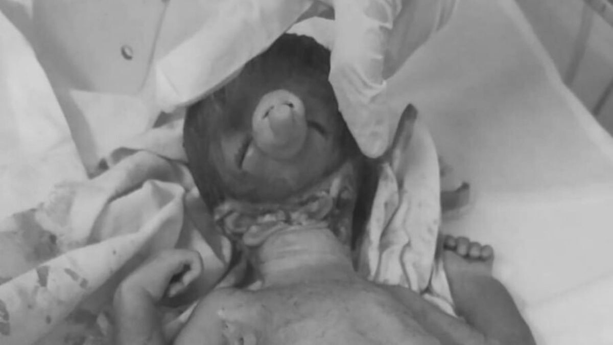 दौसा में जन्मा अनोखा बच्चा. 