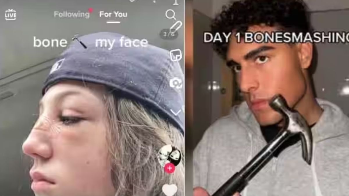 चेहरे की हड्डियां तोड़ रहे लोग, सोशल मीडिया पर खौफनाक चैलेंज वायरल