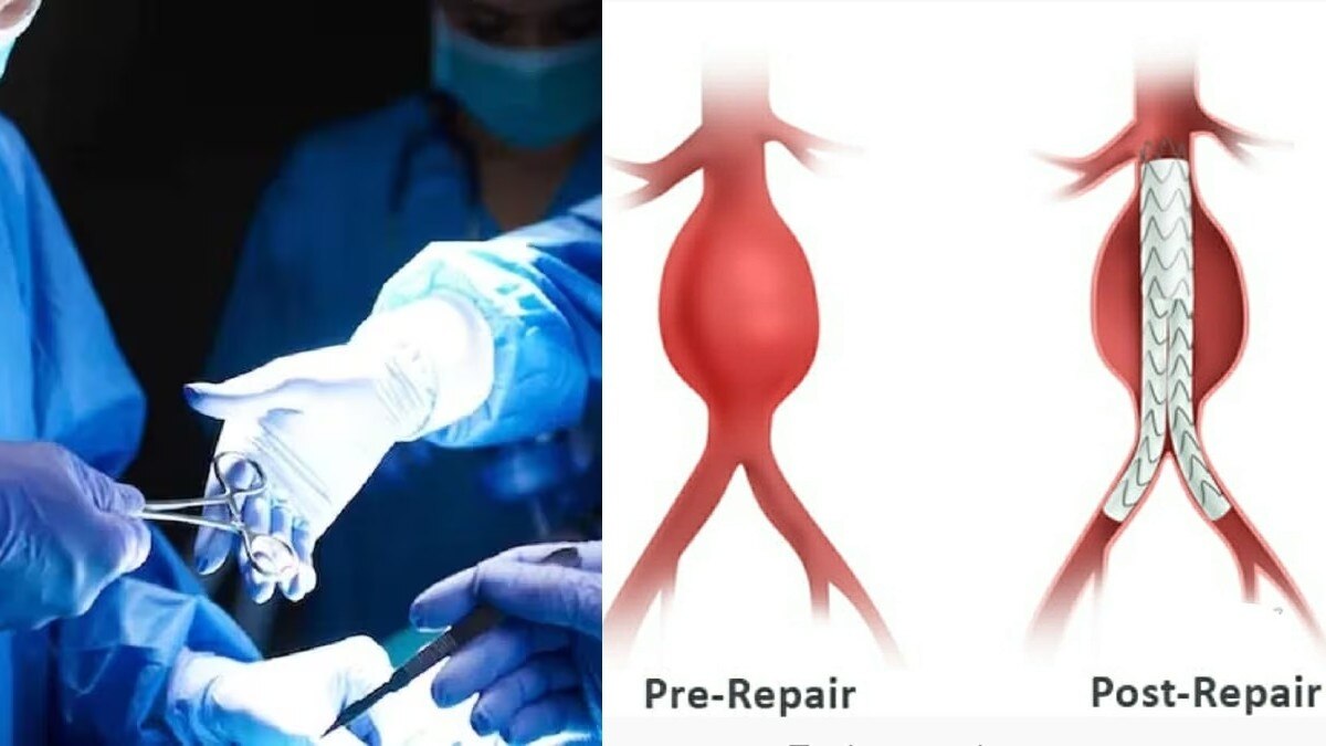 रेडियोलॉजी इन्टरवेंशनल प्रक्रिया से सफल सर्जरी. (सांकेतिक तस्वीर)