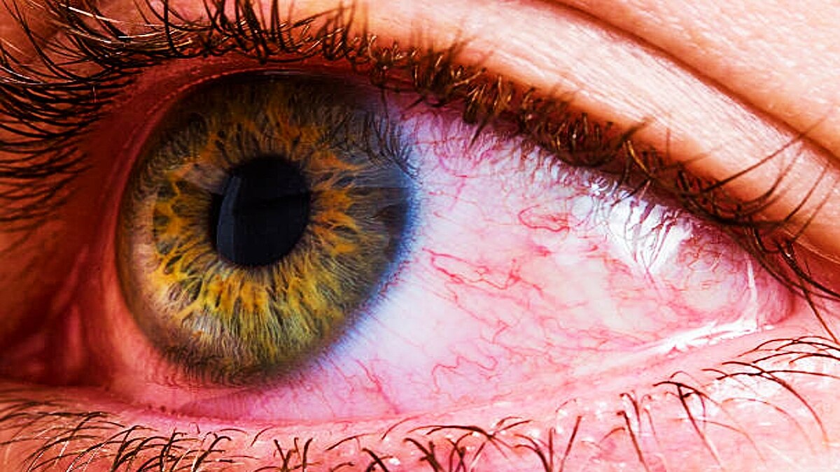 सांकेतिक फोटो